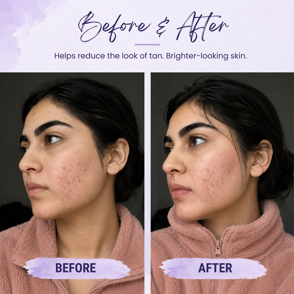 Yafé De-Tan Brightening Face Pack with Kojic Acid & Niacinamide, 50g